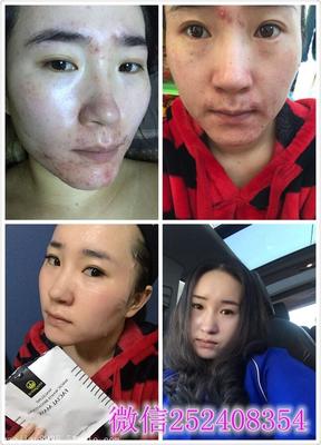 麦吉丽素颜三部曲效果与代理政策详解